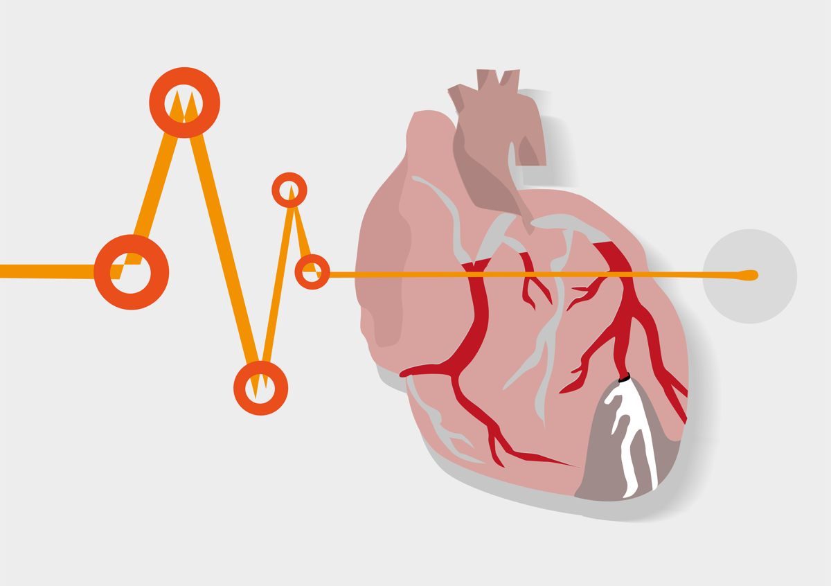 Insufficienza cardiaca: diagnosi e trattamento