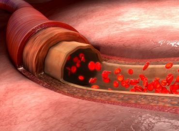 Tutti i sintomi di una cattiva circolazione sanguigna