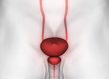 Tumore alla prostata: prevenzione e fattori di rischio