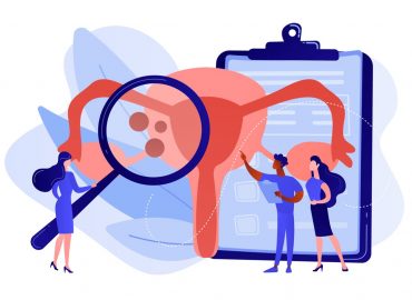 Endometriosi, questa sconosciuta: tutto quello che c'è da sapere