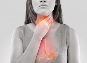 Reflusso gastroesofageo: i consigli dello specialista