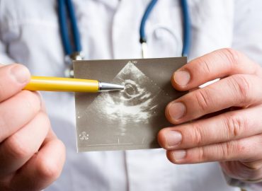 Stenosi Aortica: quali sono le cause e le conseguenze