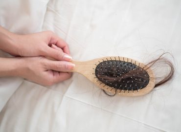 Caduta dei capelli per cause ormonali: quali i rimedi?
