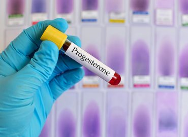 Progesterone Basso: cause e conseguenze