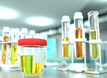 Proteine nelle urine: cosa vuol dire e cosa fare?