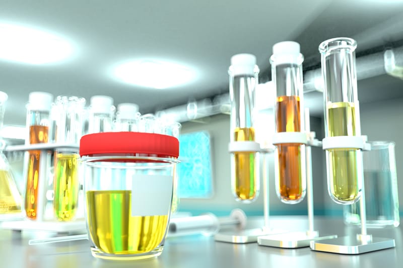 Proteine nelle urine: cosa vuol dire e cosa fare?
