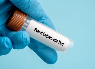 Calprotectina fecale: un marcatore per l’infiammazione intestinale