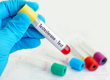 Testosterone e salute femminile: l'importanza di un ormone spesso trascurato nelle donne