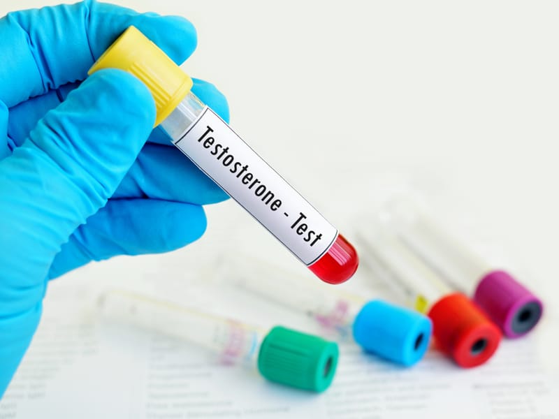 Testosterone e salute femminile: l’importanza di un ormone spesso trascurato nelle donne