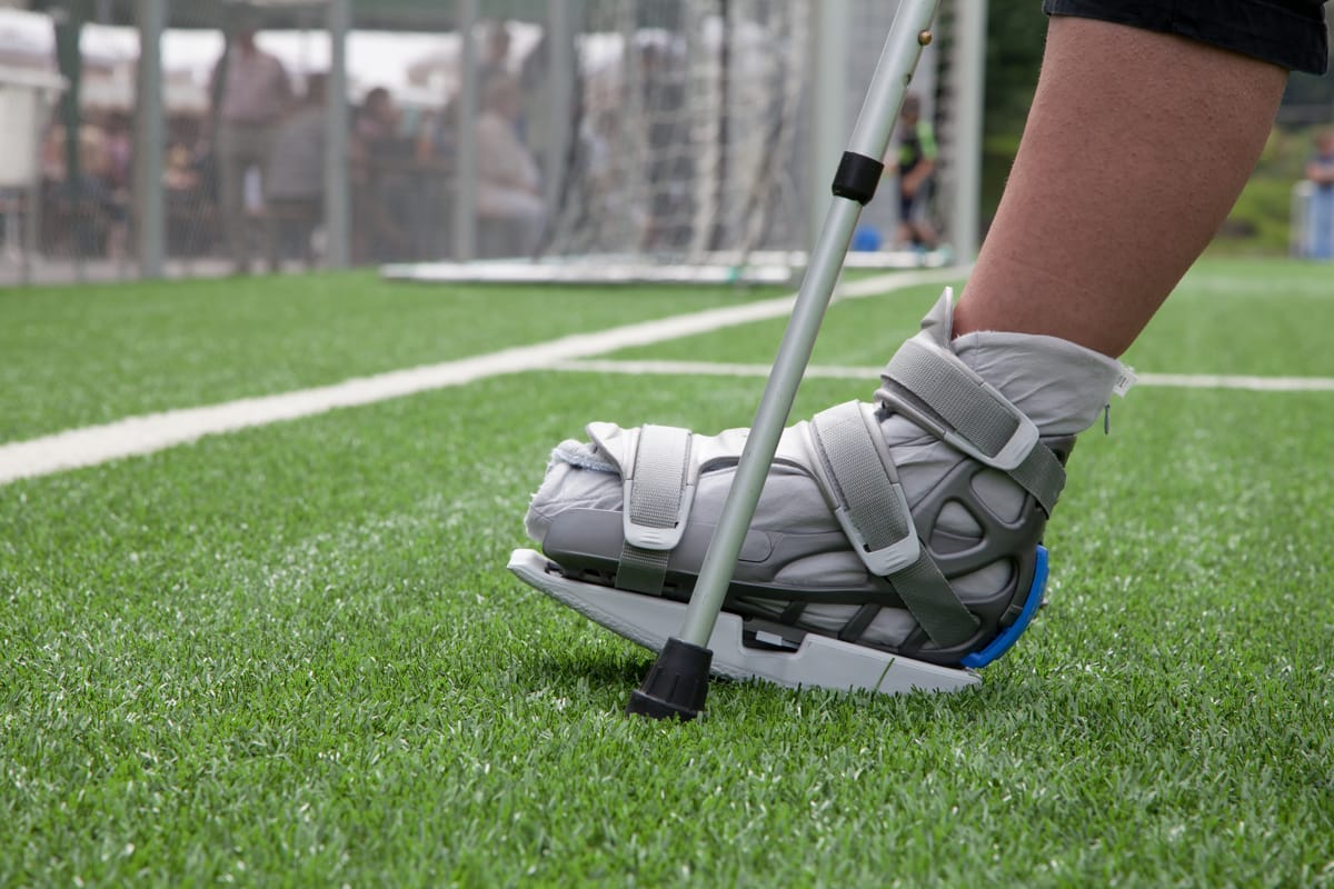 Ritorno allo sport dopo una frattura: tempi, strategie e consigli