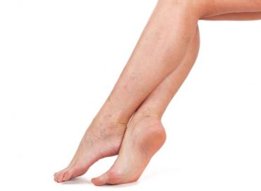 Microcircolazione: perché prendersi cura dei piccoli vasi sanguigni