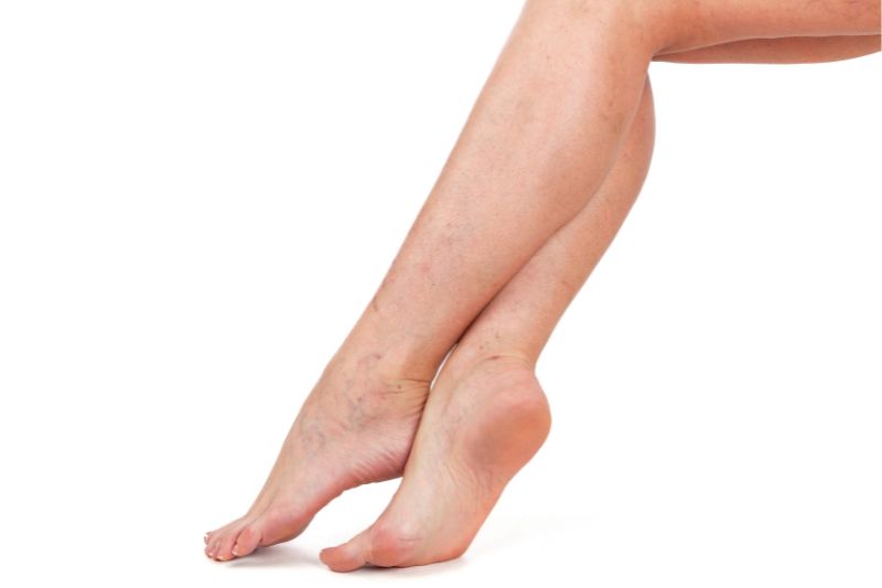 Microcircolazione: perché prendersi cura dei piccoli vasi sanguigni