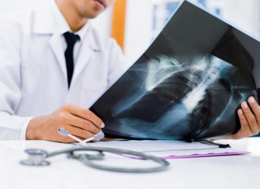 Addensamento polmonare: cause, sintomi e diagnosi