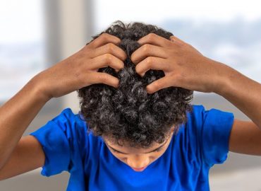 Croste in testa: cause, rimedi e quando preoccuparsi