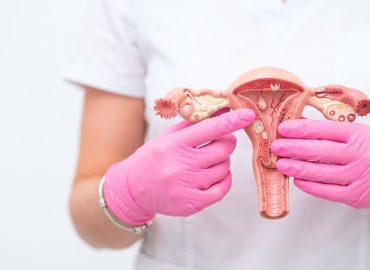 Cisti di Naboth: cosa sono e perché si scoprono spesso durante una visita ginecologica
